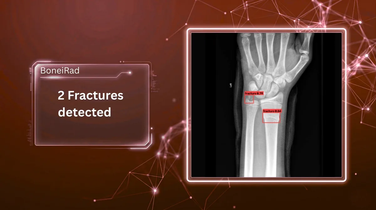 BoneRad marking two fractures on a wrist X-ray with bounding boxes