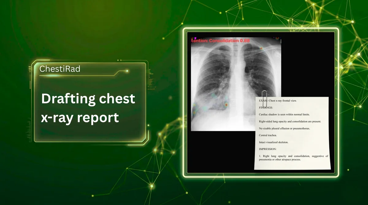 ChestiRad drafting a chest X-ray report beside the annotated radiograph